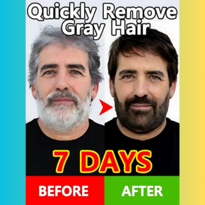 Before-and-after image of a man transforming his gray hair to dark in 7 days with Shopizan’s gray hair removal solution, featuring bold text highlighting the rapid results.