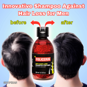 Folicerin Anti-Hair Loss Shampoo for Men: Before-and-after comparison showing reduced balding and thicker hair, with a red bottle featuring 'ANTI-HAIR LOSS SHAMPOO FOR MEN' label