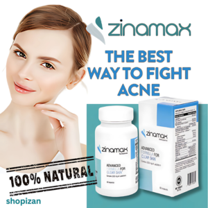 A smiling woman with clear skin holds Zinamax acne supplement bottle and box. Text highlights '100% Natural' and 'The Best Way to Fight Acne' by Shopizan.